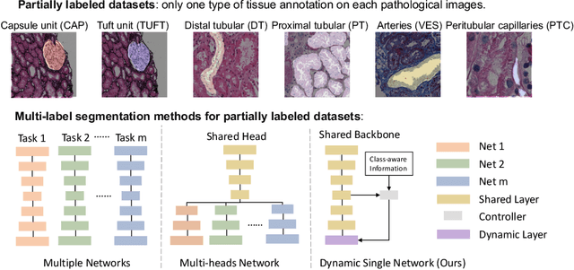 Figure 1 for Omni-Seg: A Single Dynamic Network for Multi-label Renal Pathology Image Segmentation using Partially Labeled Data