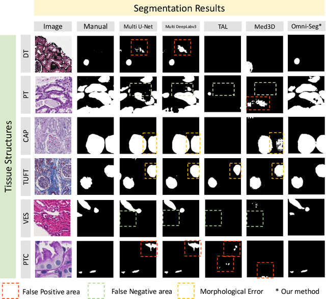 Figure 4 for Omni-Seg: A Single Dynamic Network for Multi-label Renal Pathology Image Segmentation using Partially Labeled Data