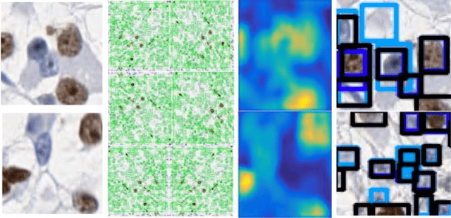 Figure 1 for Multi-scale Deep Learning Architecture for Nucleus Detection in Renal Cell Carcinoma Microscopy Image