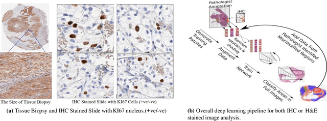 Figure 3 for Multi-scale Deep Learning Architecture for Nucleus Detection in Renal Cell Carcinoma Microscopy Image