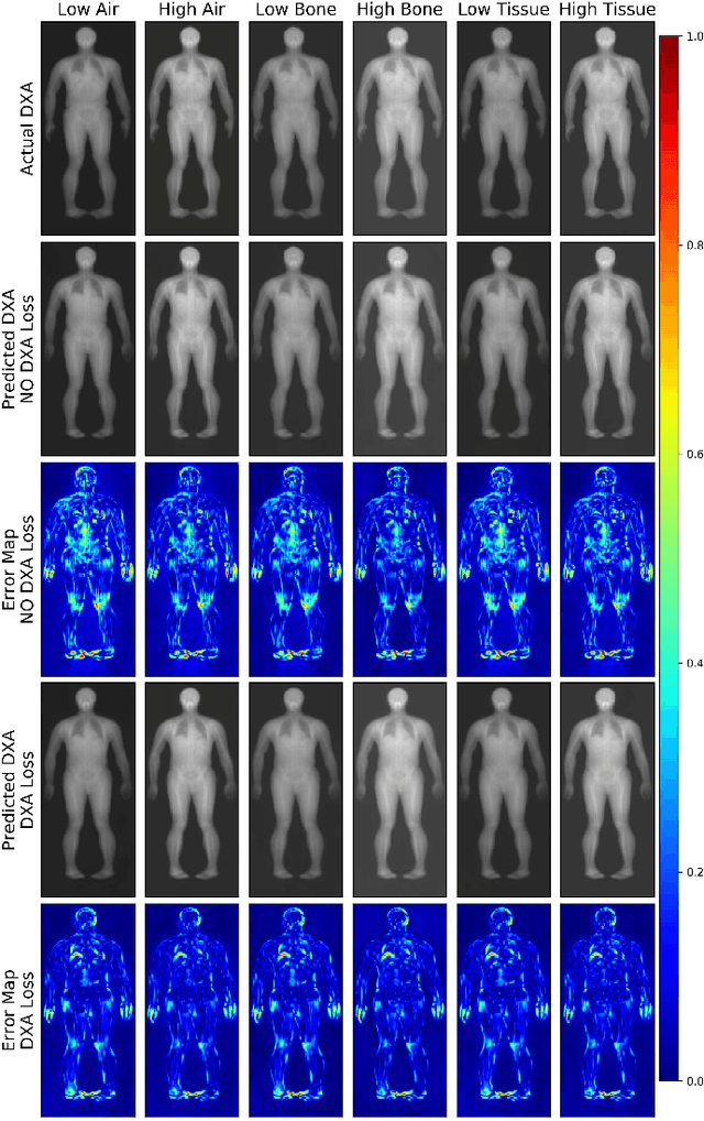 Figure 3 for Quantitative Imaging Principles Improves Medical Image Learning