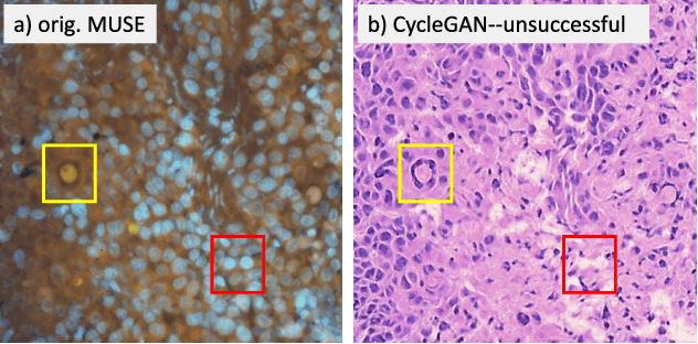 Figure 1 for Slide-free MUSE Microscopy to H&E Histology Modality Conversion via Unpaired Image-to-Image Translation GAN Models