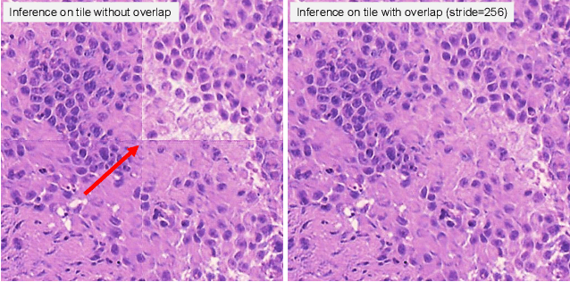 Figure 4 for Slide-free MUSE Microscopy to H&E Histology Modality Conversion via Unpaired Image-to-Image Translation GAN Models