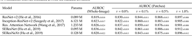 Figure 2 for End-to-end Prostate Cancer Detection in bpMRI via 3D CNNs: Effect of Attention Mechanisms, Clinical Priori and Decoupled False Positive Reduction