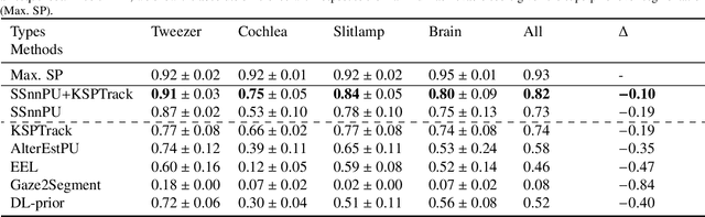 Figure 2 for A Positive/Unlabeled Approach for the Segmentation of Medical Sequences using Point-Wise Supervision