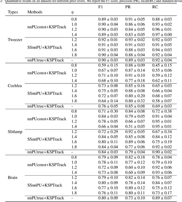 Figure 4 for A Positive/Unlabeled Approach for the Segmentation of Medical Sequences using Point-Wise Supervision