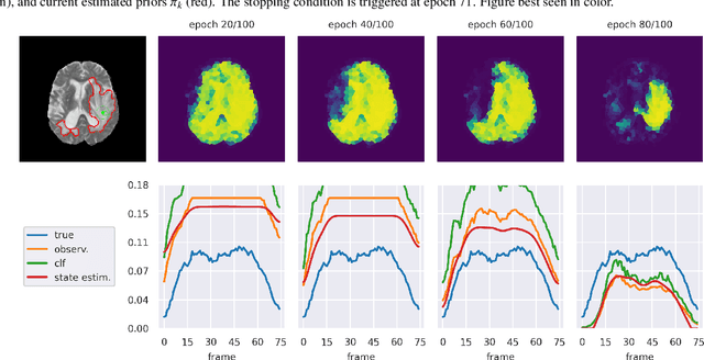 Figure 3 for A Positive/Unlabeled Approach for the Segmentation of Medical Sequences using Point-Wise Supervision