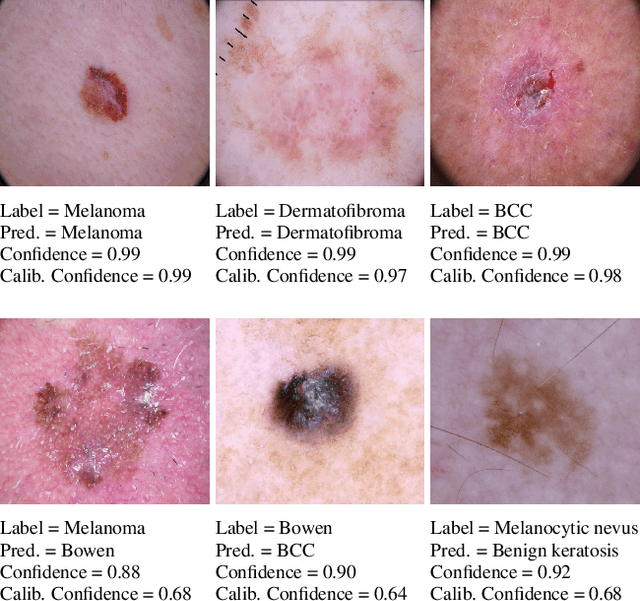 Figure 3 for Unsupervised Temperature Scaling: Post-Processing Unsupervised Calibration of Deep Models Decisions