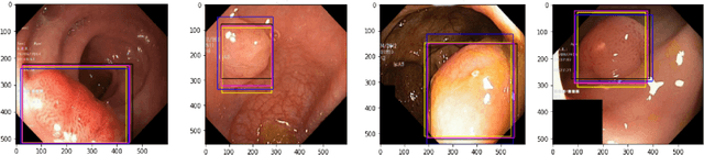 Figure 4 for Augmenting Knowledge Distillation With Peer-To-Peer Mutual Learning For Model Compression
