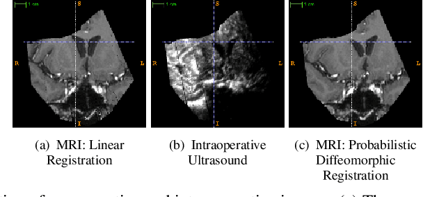 Figure 2 for Probabilistic Diffeomorphic Registration: Representing Uncertainty