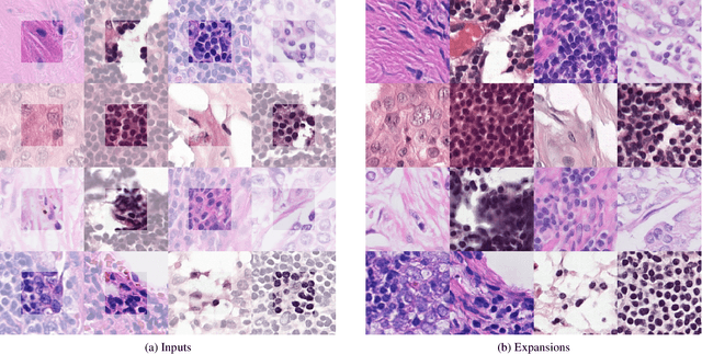 Figure 3 for Self-Supervised Representation Learning using Visual Field Expansion on Digital Pathology