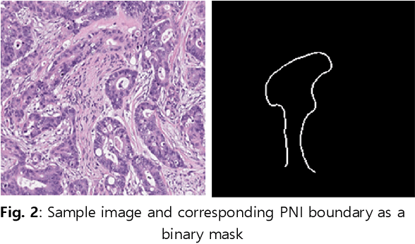 Figure 3 for Perineural Invasion Detection in Multiple Organ Cancer Based on Deep Convolutional Neural Network