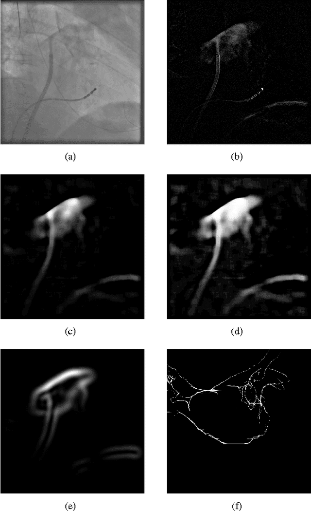 Figure 2 for 3-D/2-D Registration of Cardiac Structures by 3-D Contrast Agent Distribution Estimation