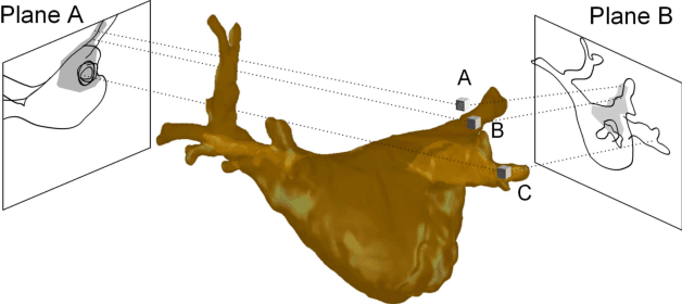 Figure 3 for 3-D/2-D Registration of Cardiac Structures by 3-D Contrast Agent Distribution Estimation