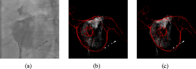 Figure 4 for 3-D/2-D Registration of Cardiac Structures by 3-D Contrast Agent Distribution Estimation