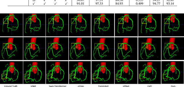 Figure 3 for Deep 3D Vessel Segmentation based on Cross Transformer Network