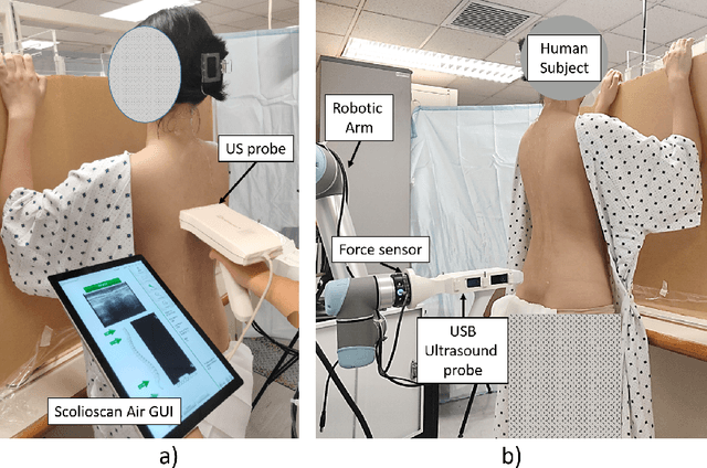 Figure 1 for Reliability of Robotic Ultrasound Scanning for Scoliosis Assessment in Comparison with Manual Scanning