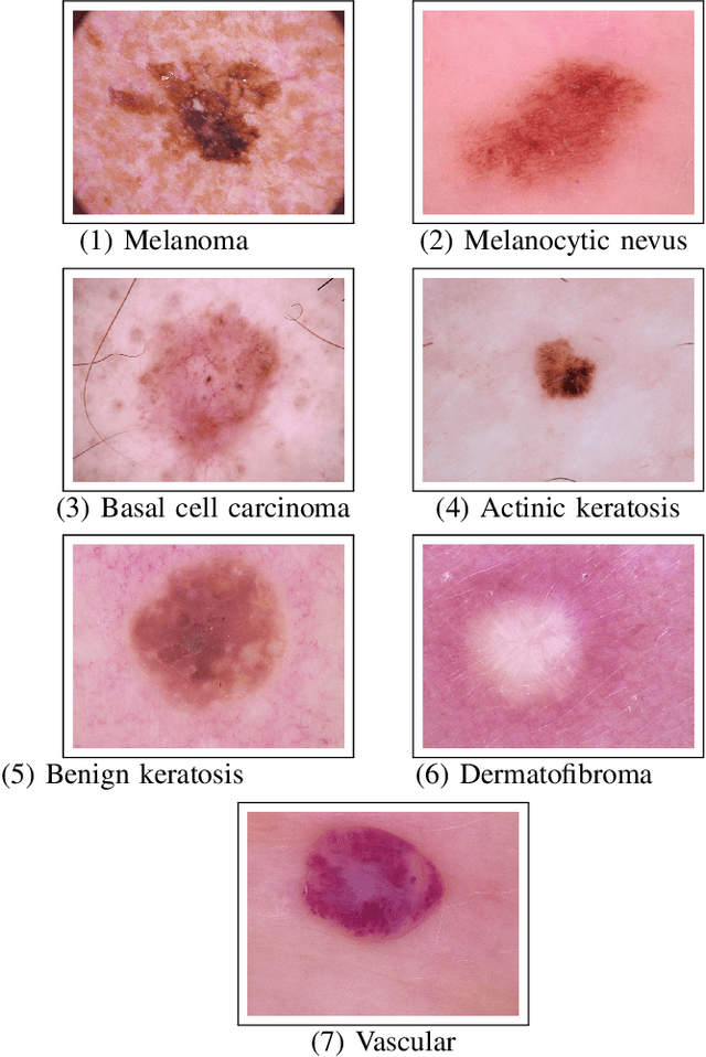 Figure 1 for Skin disease identification from dermoscopy images using deep convolutional neural network