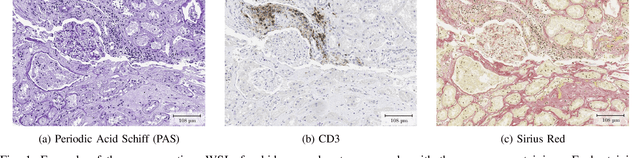 Figure 1 for An automatic framework to study the tissue micro-environment of renal glomeruli in differently stained consecutive digital whole slide images