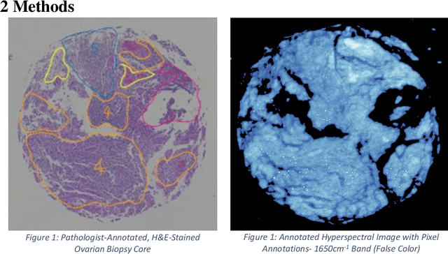 Figure 1 for Lymphocyte Classification in Hyperspectral Images of Ovarian Cancer Tissue Biopsy Samples