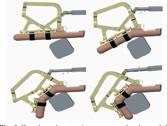 Figure 4 for Design and Kinematic Optimization of a Novel Underactuated Robotic Hand Exoskeleton