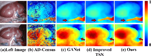 Figure 1 for Bidirectional Semi-supervised Dual-branch CNN for Robust 3D Reconstruction of Stereo Endoscopic Images via Adaptive Cross and Parallel Supervisions