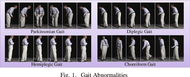 Figure 1 for Detection of Gait Abnormalities caused by Neurological Disorders