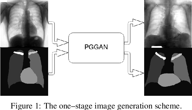 Figure 1 for A multi-stage GAN for multi-organ chest X-ray image generation and segmentation