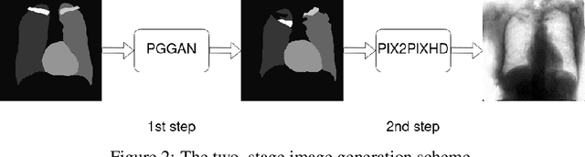 Figure 3 for A multi-stage GAN for multi-organ chest X-ray image generation and segmentation