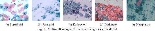 Figure 1 for Towards Interpretable Attention Networks for Cervical Cancer Analysis