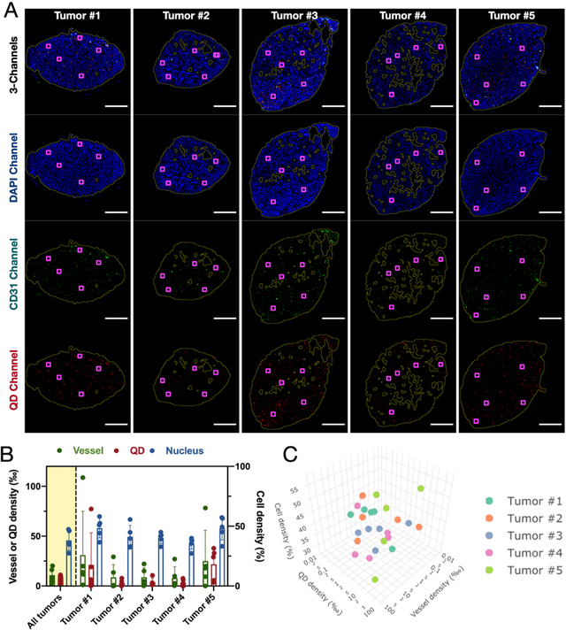 Figure 4 for GANDA: A deep generative adversarial network predicts the spatial distribution of nanoparticles in tumor pixelly