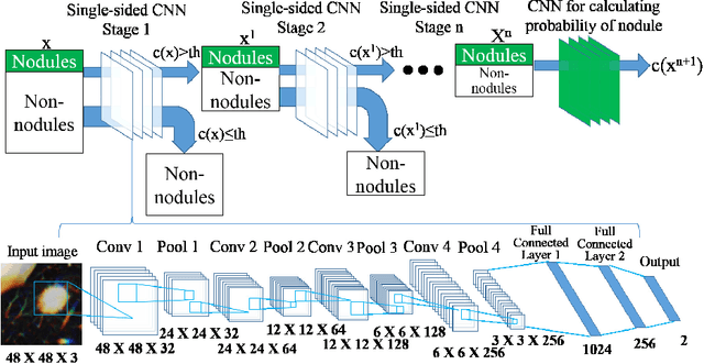 Figure 2 for Multi-stage Neural Networks with Single-sided Classifiers for False Positive Reduction and its Evaluation using Lung X-ray CT Images