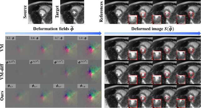 Figure 4 for Diffusion Deformable Model for 4D Temporal Medical Image Generation