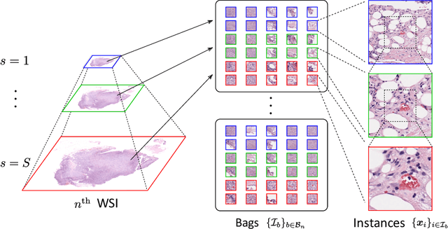Figure 1 for Multi-scale domain-adversarial multiple-instance CNN for cancer subtype classification with non-annotated histopathological images