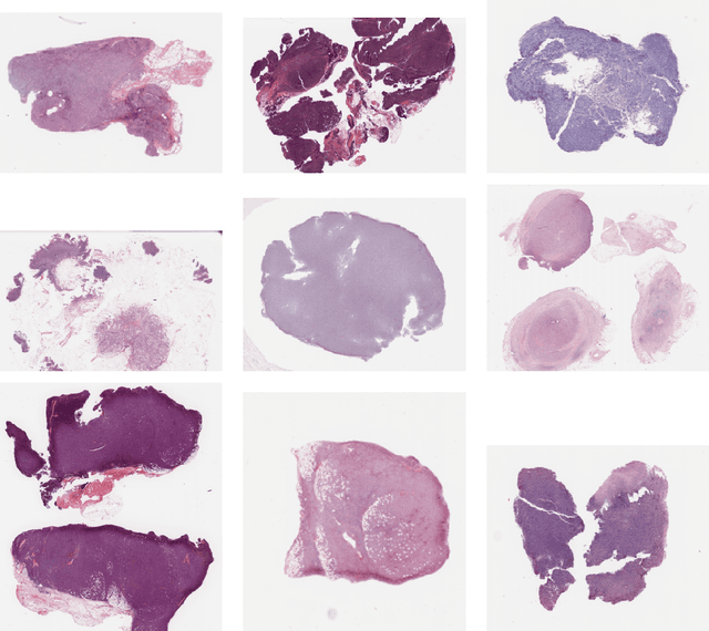 Figure 4 for Multi-scale domain-adversarial multiple-instance CNN for cancer subtype classification with non-annotated histopathological images