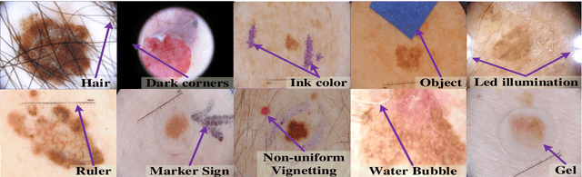 Figure 3 for Dermo-DOCTOR: A framework for concurrent skin lesion detection and recognition using a deep convolutional neural network with end-to-end dual encoders
