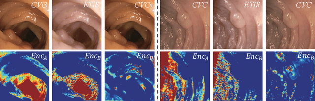 Figure 4 for MI^2GAN: Generative Adversarial Network for Medical Image Domain Adaptation using Mutual Information Constraint