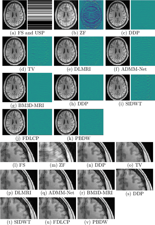 Figure 1 for MR image reconstruction using deep density priors