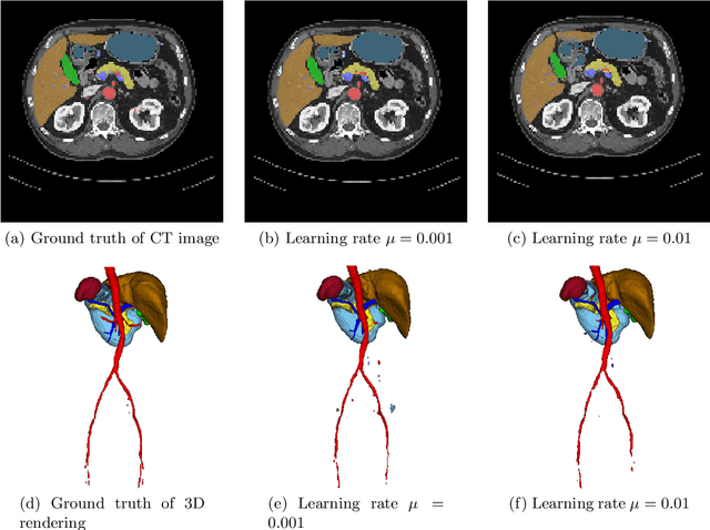 Figure 3 for On the influence of Dice loss function in multi-class organ segmentation of abdominal CT using 3D fully convolutional networks