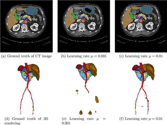 Figure 4 for On the influence of Dice loss function in multi-class organ segmentation of abdominal CT using 3D fully convolutional networks