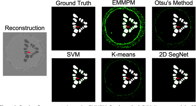 Figure 1 for 3D Convolutional Neural Networks for Dendrite Segmentation Using Fine-Tuning and Hyperparameter Optimization