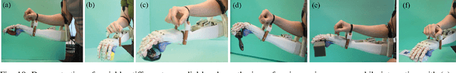 Figure 2 for Design, Implementation and Evaluation of a Variable Stiffness Transradial Hand Prosthesis