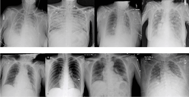 Figure 1 for COVID-19 Detection on Chest X-Ray Images: A comparison of CNN architectures and ensembles