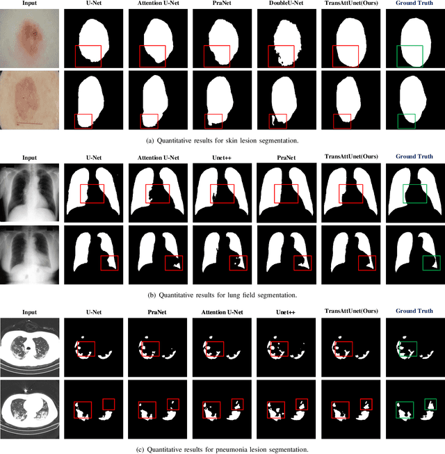 Figure 4 for TransAttUnet: Multi-level Attention-guided U-Net with Transformer for Medical Image Segmentation