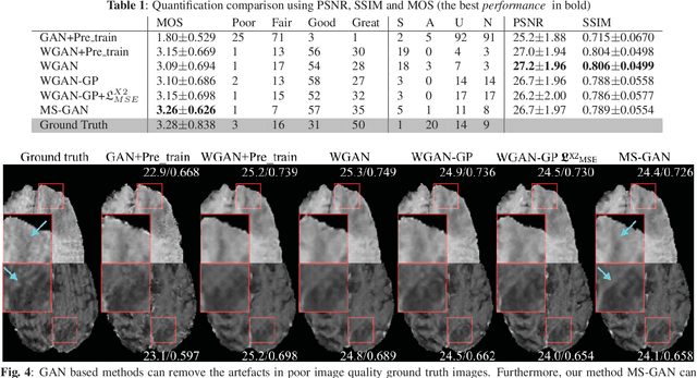 Figure 2 for How Can We Make GAN Perform Better in Single Medical Image Super-Resolution? A Lesion Focused Multi-Scale Approach