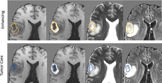Figure 3 for Sequential 3D U-Nets for Biologically-Informed Brain Tumor Segmentation
