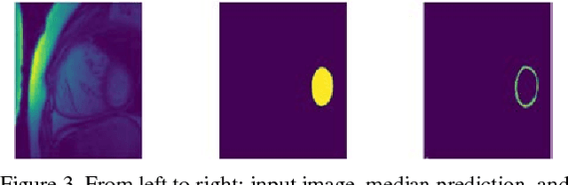 Figure 4 for Left ventricle segmentation By modelling uncertainty in prediction of deep convolutional neural networks and adaptive thresholding inference