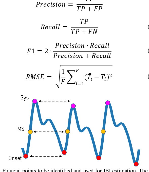 Figure 4 for Boosted-SpringDTW for Comprehensive Feature Extraction of Physiological Signals