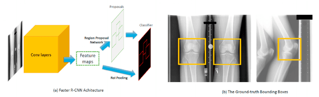 Figure 4 for Deep learning-based algorithm for assessment of knee osteoarthritis severity in radiographs matches performance of radiologists