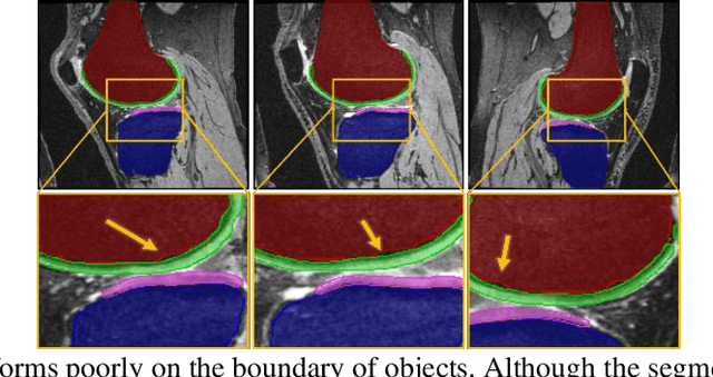 Figure 1 for Improved-Mask R-CNN: Towards an Accurate Generic MSK MRI instance segmentation platform